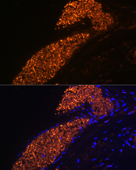 HBG1/2 Rabbit Monoclonal Antibody - Image 2