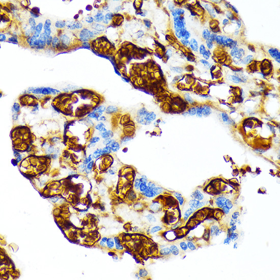 HBG1/2 Rabbit Monoclonal Antibody - Image 2