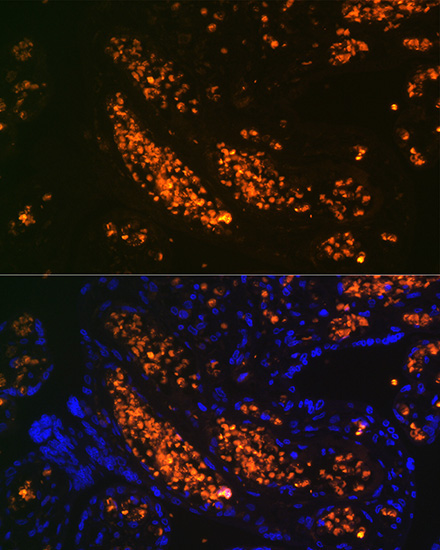 HBG1/2 Rabbit Monoclonal Antibody - Image 3