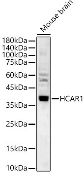HCAR1 Rabbit Polyclonal Antibody