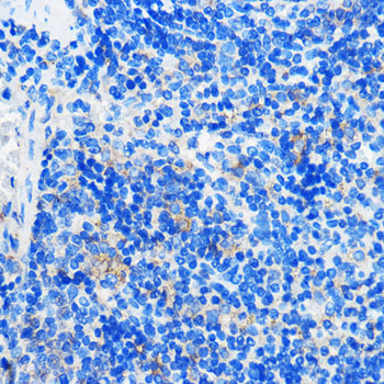 HCAR3 Rabbit Polyclonal Antibody - Image 2