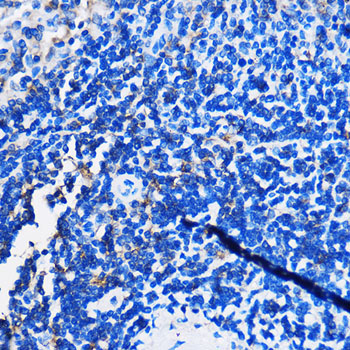 HCAR3 Rabbit Polyclonal Antibody - Image 3