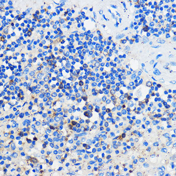 HCAR3 Rabbit Polyclonal Antibody - Image 4