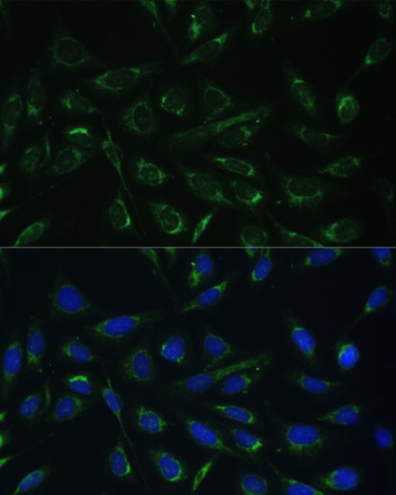 HCCS Rabbit Polyclonal Antibody - Image 2