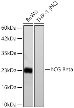 hCG Beta Rabbit Monoclonal Antibody