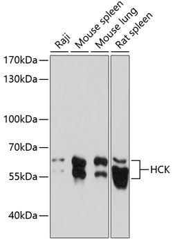 HCK Rabbit Polyclonal Antibody