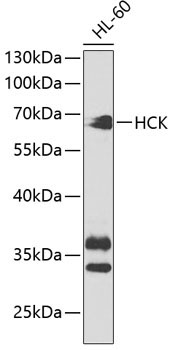 HCK Rabbit Polyclonal Antibody