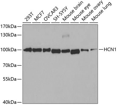 HCN1 Rabbit Polyclonal Antibody