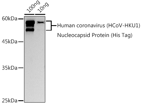 HCoV-HKU1 Nucleoprotein Rabbit Polyclonal Antibody
