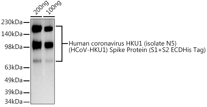 HCoV-HKU1 Spike S1 Rabbit Polyclonal Antibody