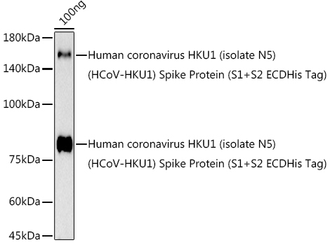 HCoV-HKU1 Spike S2 Rabbit Polyclonal Antibody