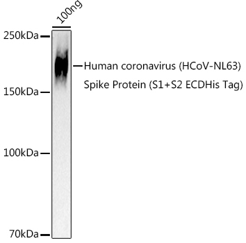 HCoV-NL63 Spike S2 Rabbit Polyclonal Antibody