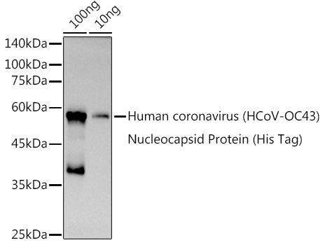 HCoV-OC43 Nucleoprotein Rabbit Polyclonal Antibody
