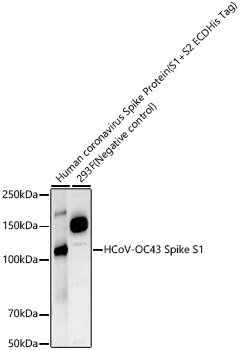 HCoV-OC43 Spike S1 Rabbit Monoclonal Antibody