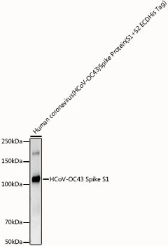 HCoV-OC43 Spike S1 Rabbit Monoclonal Antibody