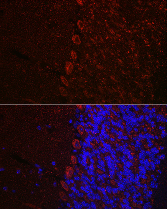 HCRTR1 Rabbit Polyclonal Antibody - Image 2