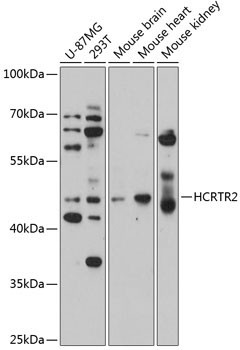 HCRTR2 Rabbit Polyclonal Antibody