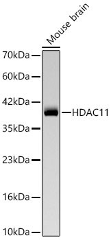 HDAC11 Rabbit Monoclonal Antibody