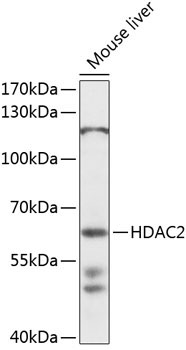 HDAC2 Rabbit Polyclonal Antibody