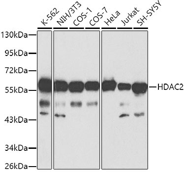 HDAC2 Rabbit Polyclonal Antibody