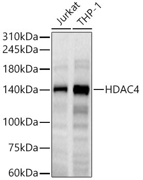 HDAC4 Rabbit Monoclonal Antibody