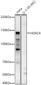 HDAC4 Rabbit Polyclonal Antibody