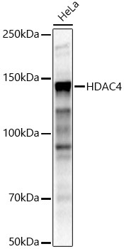 HDAC4 Rabbit Polyclonal Antibody