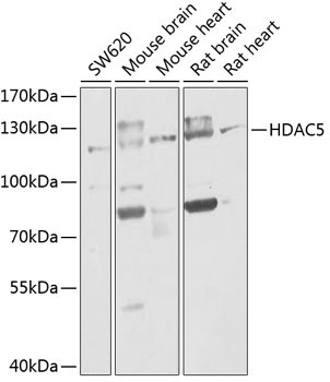 HDAC5 Rabbit Polyclonal Antibody