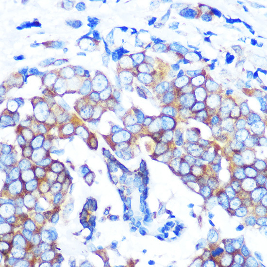 HDAC6 Rabbit Monoclonal Antibody - Image 2