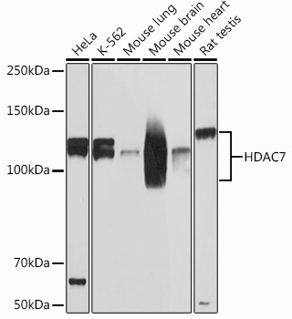 HDAC7 Rabbit Monoclonal Antibody