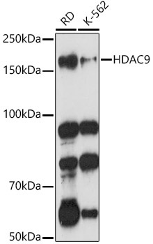 HDAC9 Rabbit Polyclonal Antibody