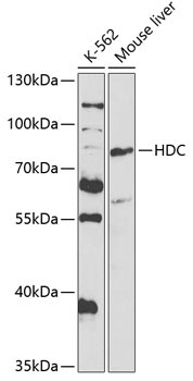 HDC Rabbit Polyclonal Antibody