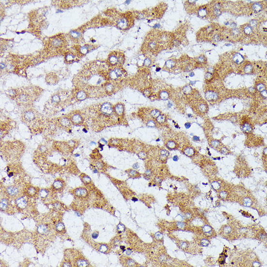 HDLBP Rabbit Polyclonal Antibody - Image 3