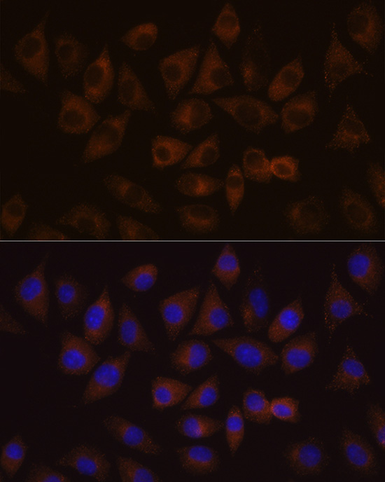 HDLBP Rabbit Polyclonal Antibody - Image 5