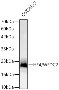 HE4/WFDC2 Rabbit Monoclonal Antibody