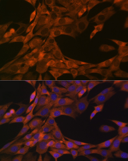 HE4/WFDC2 Rabbit Monoclonal Antibody - Image 2