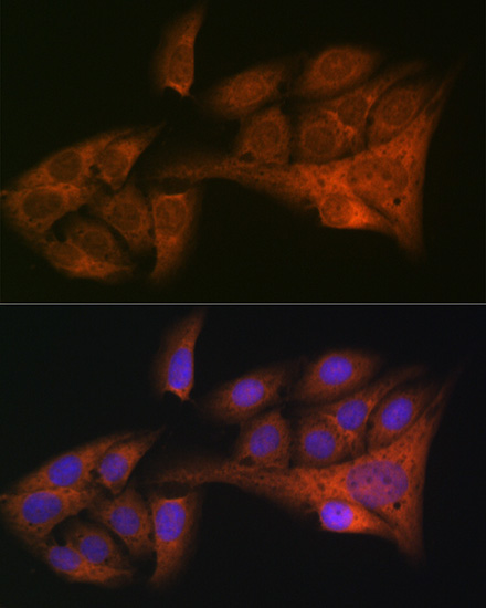 HE4/WFDC2 Rabbit Monoclonal Antibody - Image 3
