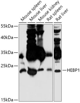 HEBP1 Rabbit Polyclonal Antibody
