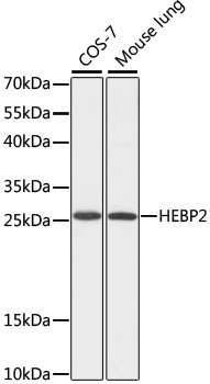 HEBP2 Rabbit Polyclonal Antibody