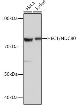 HEC1/NDC80 Rabbit Monoclonal Antibody