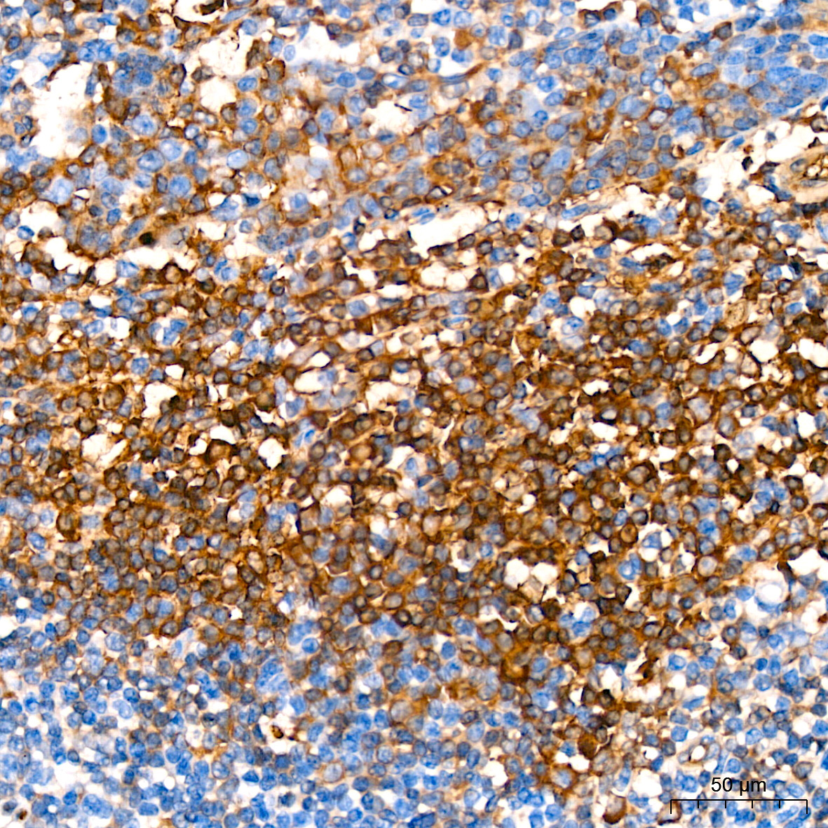 Hemoglobin subunit alpha (HBA1) Rabbit Monoclonal Antibody - Image 4