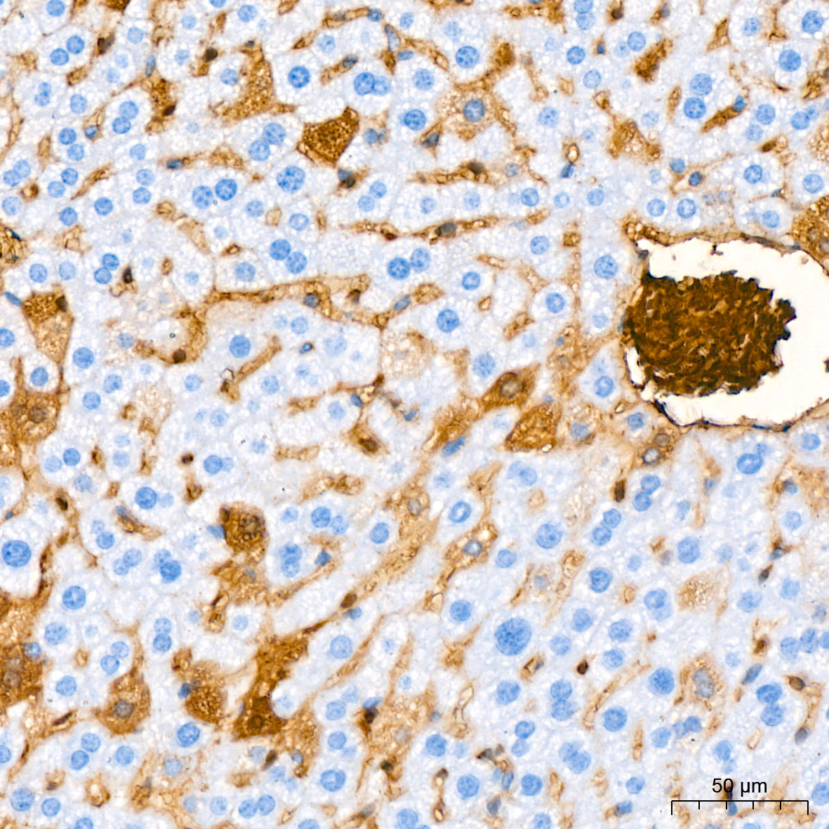 Hemoglobin subunit alpha (HBA1) Rabbit Monoclonal Antibody - Image 5