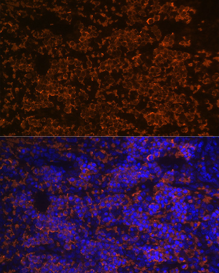 Hemoglobin subunit alpha (HBA1) Rabbit Monoclonal Antibody - Image 7