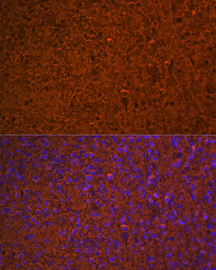Hemoglobin subunit alpha (HBA1) Rabbit Monoclonal Antibody - Image 8