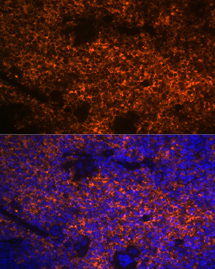 Hemoglobin subunit alpha (HBA1) Rabbit Monoclonal Antibody - Image 9