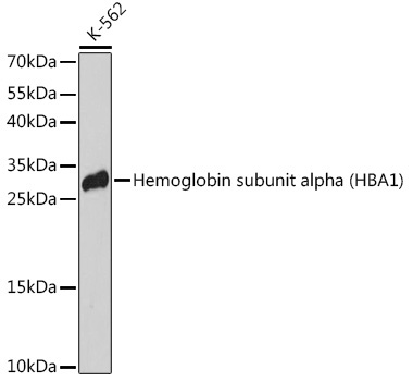 Hemoglobin subunit alpha (HBA1) Rabbit Polyclonal Antibody