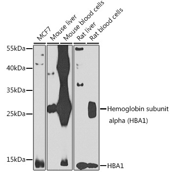 Hemoglobin subunit alpha (HBA1) Rabbit Polyclonal Antibody