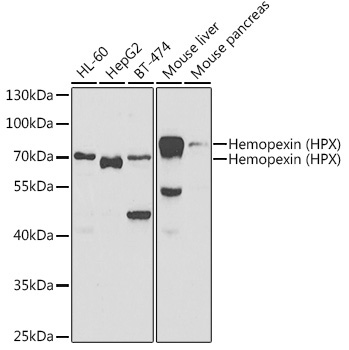 Hemopexin (HPX) Rabbit Polyclonal Antibody