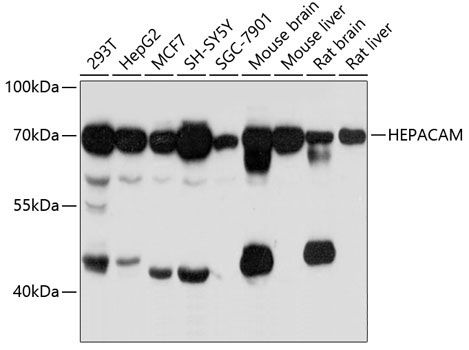 HEPACAM Rabbit Polyclonal Antibody