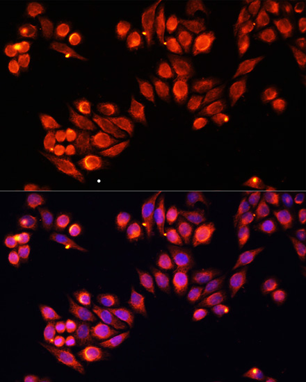 Heparanase 1 Rabbit Polyclonal Antibody - Image 2